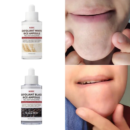 Glow Rice Ampoule Rice Essence Moisturizing and Hydrating Gentle Cleansing Peel Shot Exfoliant Repair Skin Niacinamide Essences